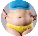 Miniabdominoplastia